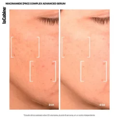 25% Niacinamide Complex*LACABINE