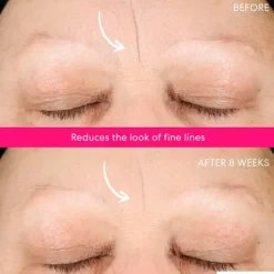 New Ageless Phyto-Aha Radiance Facial Peeling Hidratación