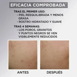 Aha+Bha Con Carbón*GARNIER New