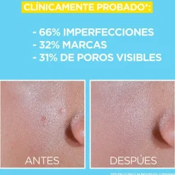 Bha + Niacinamida*GARNIER Clearance