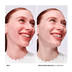 Hot Bye Bye Redness Serums