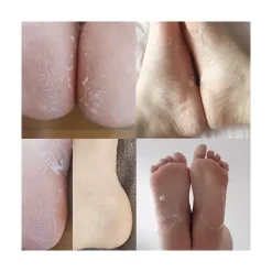 Discount Calcetines Mascarilla Exfoliante Mascarillas