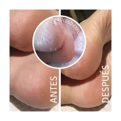 Discount Calcetines Mascarilla Exfoliante Mascarillas