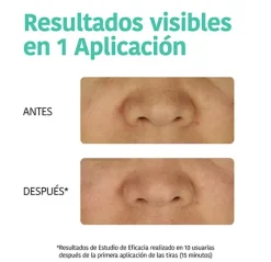 Sale IROHA NATURE Cleansing Strips Detox