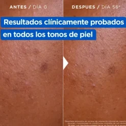 Crema Hidratante Anti-Manchas*MIXA Discount