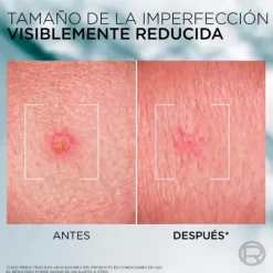 Derma Control Sos Paste*L'OREAL MEN EXPERT