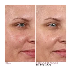 Hello Results Baby-Smooth Glycolic Peel + Caring Oil*IT COSMETICS Online