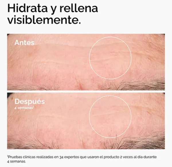 Hyaluronic Acid 2% + B5*THE ORDINARY Discount