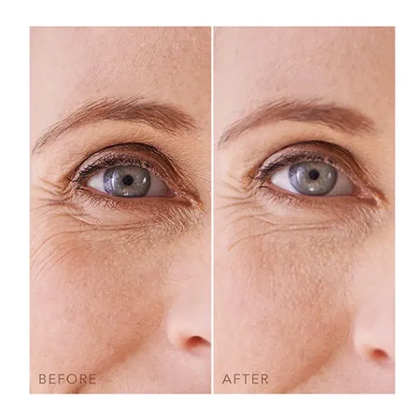 Iris Under-Eye-Patches*FOREO Discount