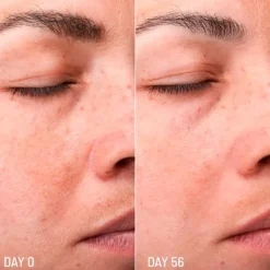 Online Lotus Radiance Dark Spot Treatment Rostro