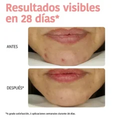 Hot Mascarilla Peeling Piel Perfecta Mascarillas