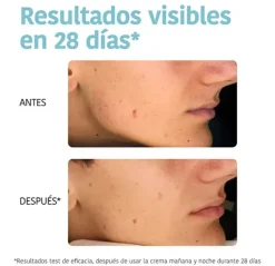 Oil Control Anti-Blemish*IROHA NATURE Best