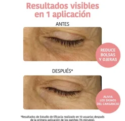 Parches Contorno Ojos*IROHA NATURE