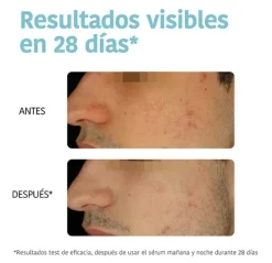 Reverent & Correct Anti-Blemish*IROHA NATURE Outlet