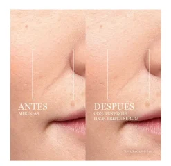 New Rénergie H.C.F. Triple Serum Serums