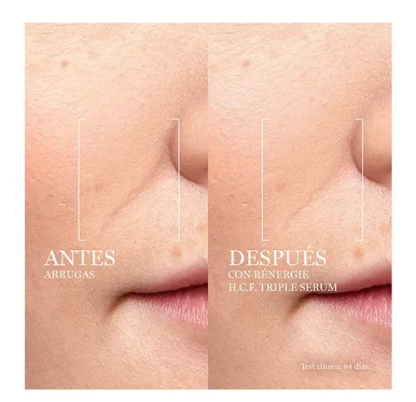 New Rénergie H.C.F. Triple Serum Serums