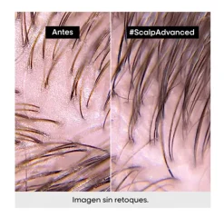 L'OREAL PROFESSIONNEL Scalp Advanced