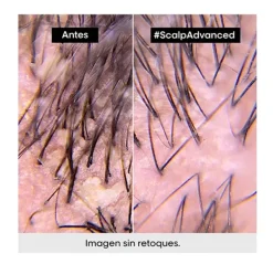 Online L'OREAL PROFESSIONNEL Scalp Advanced