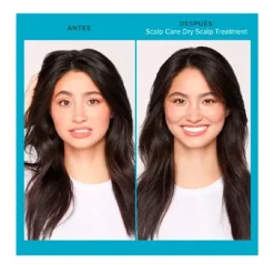 LIVING PROOF Scalp Care Dry Scalp Treatment