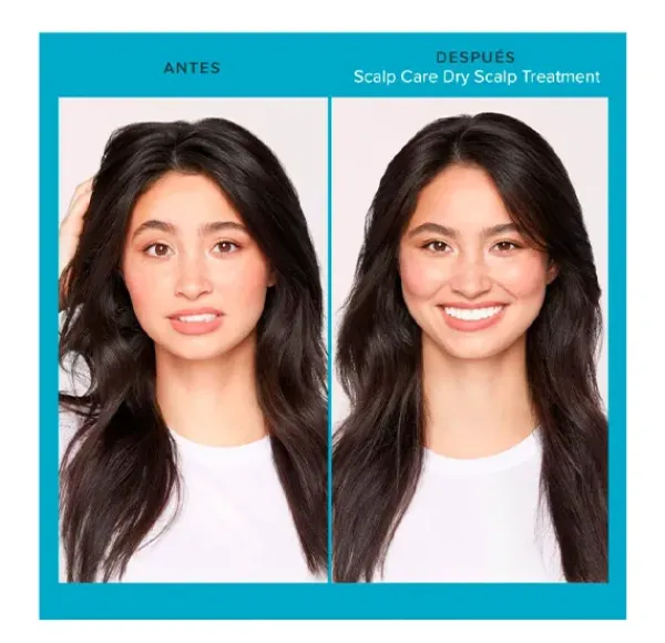 LIVING PROOF Scalp Care Dry Scalp Treatment