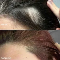 Serum De Crecimiento Del Cabello*UKLASH Hot