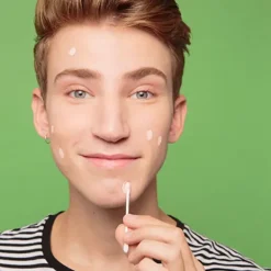 Skin Resurfacing*BYE BYE BLEMISH Sale