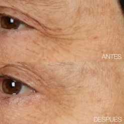 Smart Clinical Repair Overnight Recovery Cream + Mask*CLINIQUE