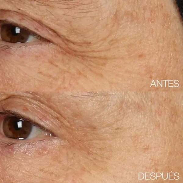 Smart Clinical Repair Overnight Recovery Cream + Mask*CLINIQUE