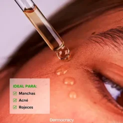 Online Soothing Azelaic Serum 10% Serums