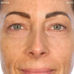 Best Transforma AHA 360 Serums