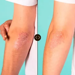 Best FRESHLY COSMETICS Vegan Hero All-Porpose Balm