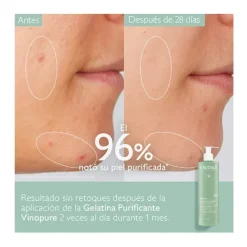 Vinopure*CAUDALIE Online